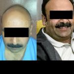 2018-03-23-photo-00072807-1